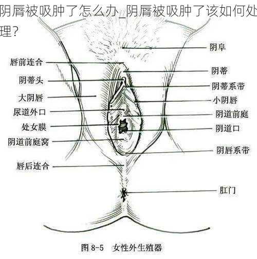 阴脣被吸肿了怎么办_阴脣被吸肿了该如何处理？